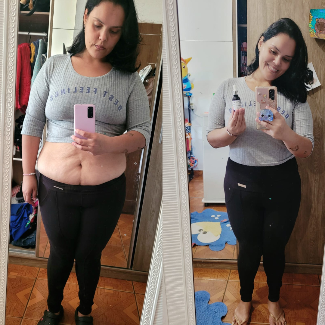 Antes e depois Mounjax - Resultado real 4