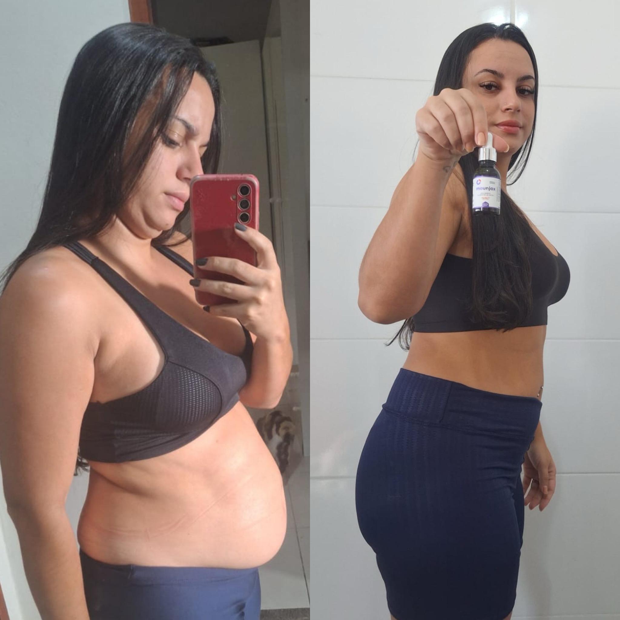Antes e depois Mounjax - Resultado real 5